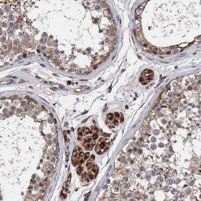 Immunohistochemistry-Paraffin: CNNM1 Antibody [NBP1-89281]