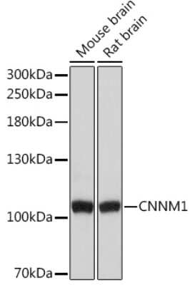 Western Blot: CNNM1 AntibodyAzide and BSA Free [NBP3-15497]