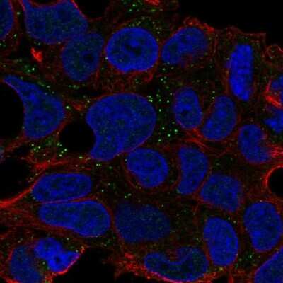 Immunocytochemistry/ Immunofluorescence: CNNM2 Antibody [NBP2-57391]