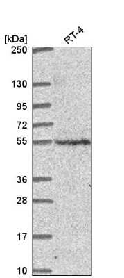 Western Blot: CNNM2 Antibody [NBP2-57086]