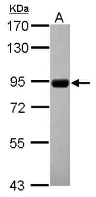 Western Blot: CNNM4 Antibody [NBP2-15927]