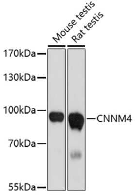 Western Blot: CNNM4 AntibodyAzide and BSA Free [NBP2-92636]