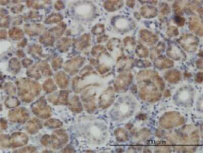 Immunohistochemistry-Paraffin: CNO Antibody (6C3) [H00055330-M02]