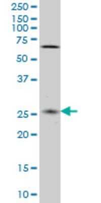 Western Blot: CNO Antibody (6C3) [H00055330-M02]