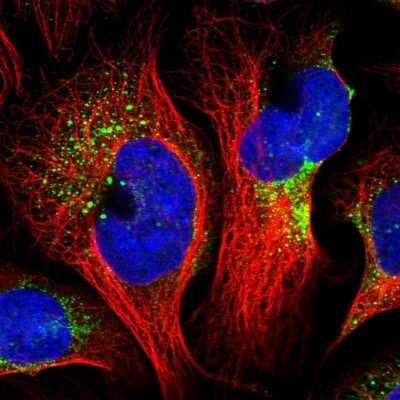 Immunocytochemistry/ Immunofluorescence: CNO Antibody [NBP1-91798]