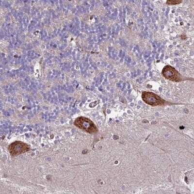 Immunohistochemistry-Paraffin: CNO Antibody [NBP1-91798]