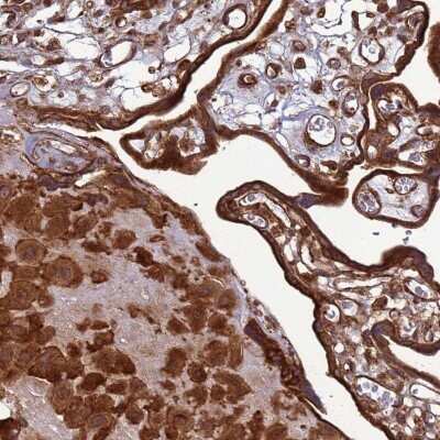 Immunohistochemistry: CNOT1 Antibody [NBP2-32045]