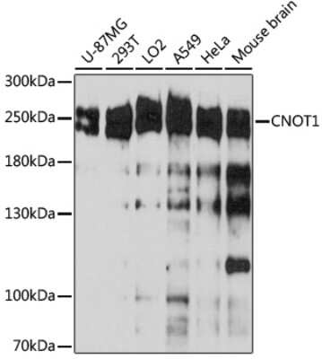 Western Blot: CNOT1 AntibodyAzide and BSA Free [NBP2-92464]