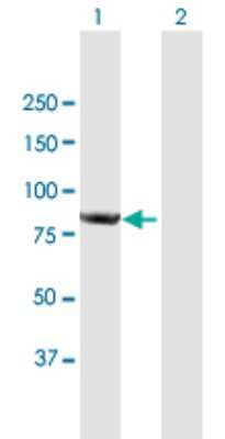 Western Blot: CNOT10 Antibody [H00025904-B01P]