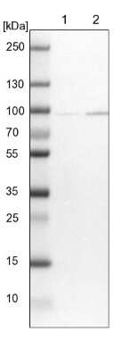 Western Blot: CNOT10 Antibody [NBP1-82278]