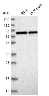 Western Blot: CNOT10 Antibody [NBP2-58959]