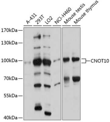 Western Blot: CNOT10 AntibodyAzide and BSA Free [NBP2-92059]