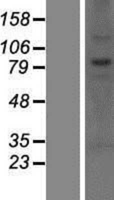 Western Blot: CNOT10 Overexpression Lysate [NBP2-07173]