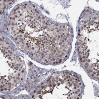 Immunohistochemistry-Paraffin: CNOT11 Antibody [NBP3-17356]