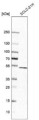 Western Blot: CNOT11 Antibody [NBP2-55823]