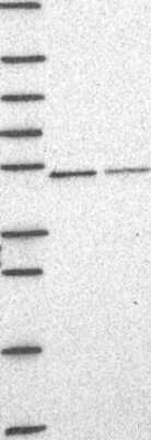 Western Blot: CNOT11 Antibody [NBP3-17356]