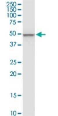 Western Blot: CNOT2 Antibody (3F1) [H00004848-M08]