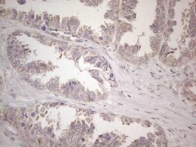 Immunohistochemistry: CNOT2 Antibody (OTI5A12) [NBP2-46323]