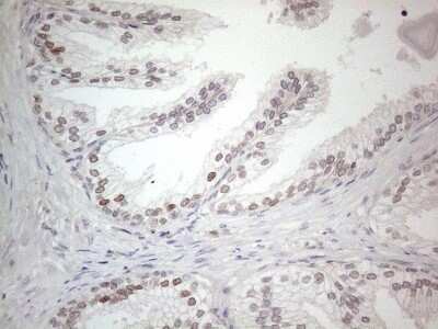 Immunohistochemistry: CNOT2 Antibody (OTI5A12) [NBP2-46323]
