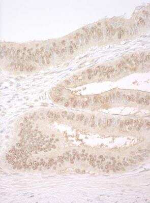 Immunohistochemistry-Paraffin: CNOT2 Antibody [NBP1-30454]