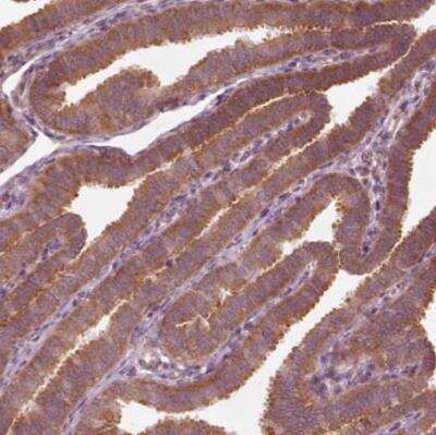 Immunohistochemistry-Paraffin: CNOT2 Antibody [NBP2-56034]