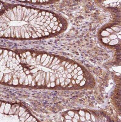 Immunohistochemistry-Paraffin: CNOT2 Antibody [NBP2-56034]