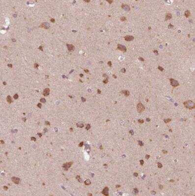 Immunohistochemistry-Paraffin: CNOT2 Antibody [NBP2-56034]