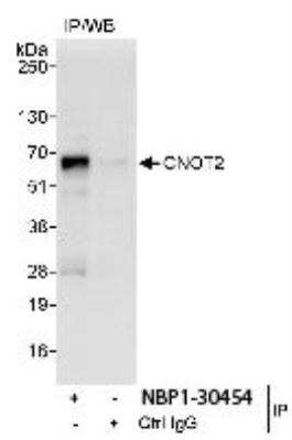 Immunoprecipitation: CNOT2 Antibody [NBP1-30454]