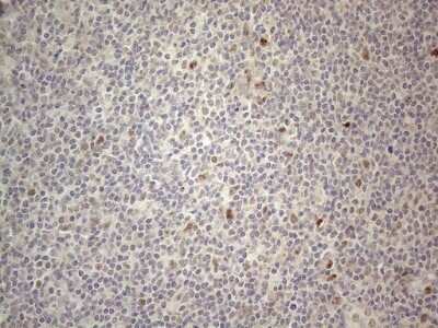 Immunohistochemistry: CNOT2 Antibody (OTI5A12) - Azide and BSA Free [NBP2-71202]