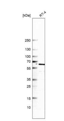 Western Blot: CNOT2 Antibody [NBP2-56034]