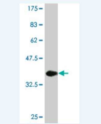 Western Blot: CNOT3 Antibody (1E8) [H00004849-M04]