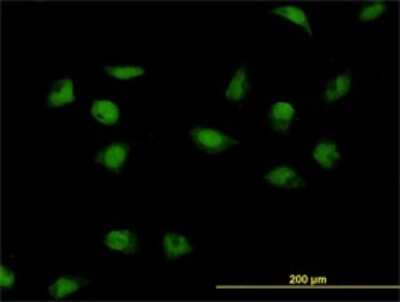 Immunocytochemistry/ Immunofluorescence: CNOT3 Antibody (4B8) [H00004849-M01]