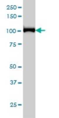 Western Blot: CNOT3 Antibody (4B8) [H00004849-M01]