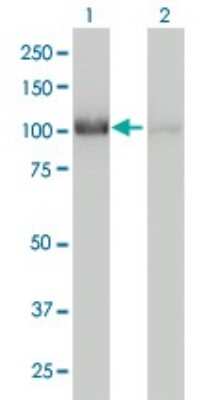 Western Blot: CNOT3 Antibody (4B8) [H00004849-M01]