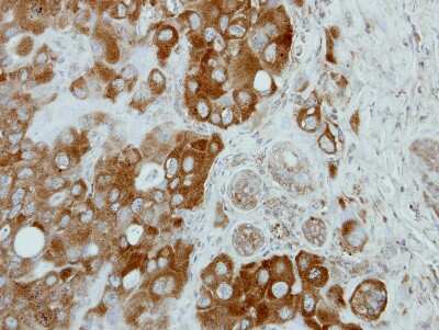 Immunohistochemistry-Paraffin: CNOT3 Antibody [NBP2-15928]