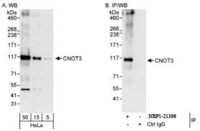 Western Blot: CNOT3 Antibody [NBP1-21396]