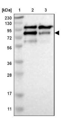 Western Blot: CNOT3 Antibody [NBP1-82971]