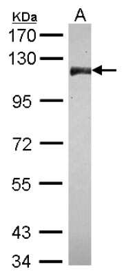 Western Blot: CNOT3 Antibody [NBP2-15928]