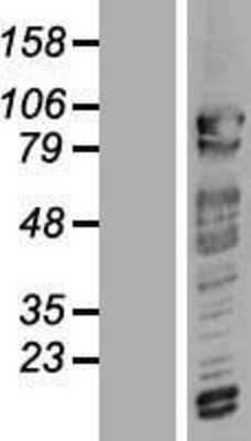 Western Blot: CNOT3 Overexpression Lysate [NBL1-09318]