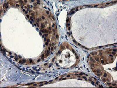 Immunohistochemistry-Paraffin: CNOT4 Antibody (OTI1H2) [NBP2-03878]