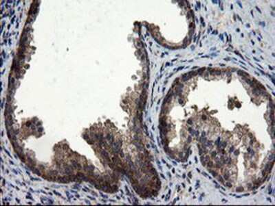 Immunohistochemistry-Paraffin: CNOT4 Antibody (OTI1H2) [NBP2-03878]