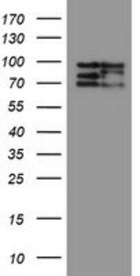 Western Blot: CNOT4 Antibody (OTI1H2) [NBP2-03878]