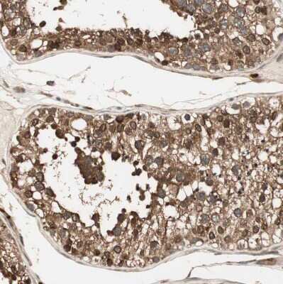 Immunohistochemistry-Paraffin: CNOT4 Antibody [NBP1-84439]