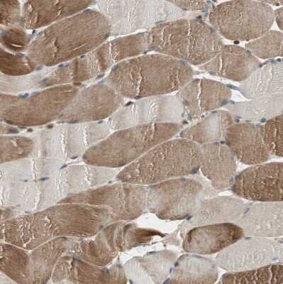 Immunohistochemistry-Paraffin: CNOT4 Antibody [NBP1-84439]