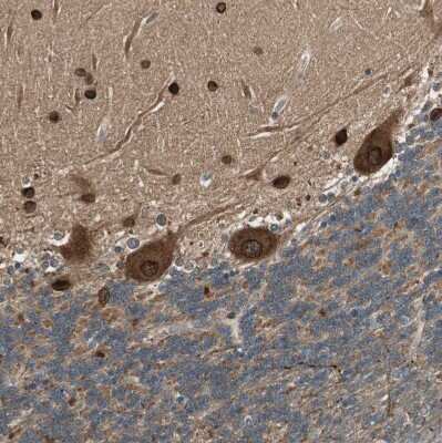 Immunohistochemistry-Paraffin: CNOT4 Antibody [NBP1-84439]