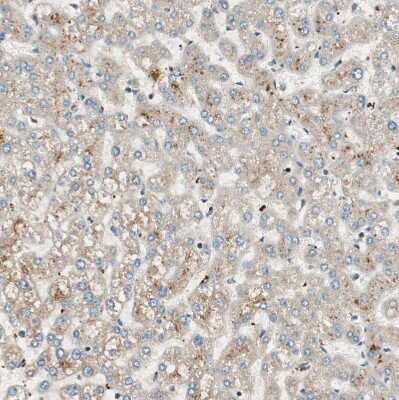 Immunohistochemistry-Paraffin: CNOT4 Antibody [NBP1-84439]