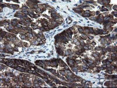 Immunohistochemistry: CNOT4 Antibody (OTI1H2) - Azide and BSA Free [NBP2-71212]