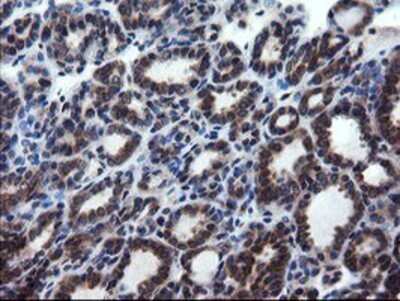 Immunohistochemistry: CNOT4 Antibody (OTI1H2) - Azide and BSA Free [NBP2-71212]