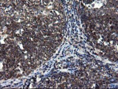 Immunohistochemistry: CNOT4 Antibody (OTI1H2) - Azide and BSA Free [NBP2-71212]