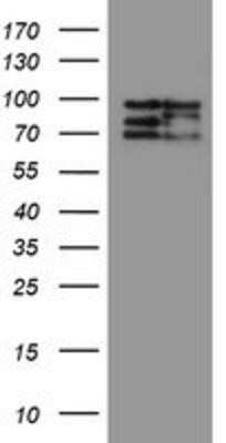 Western Blot: CNOT4 Antibody (OTI1H2)Azide and BSA Free [NBP2-71212]